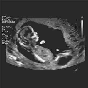 The Cosmic Factory - Ultrasound download mp3 flac